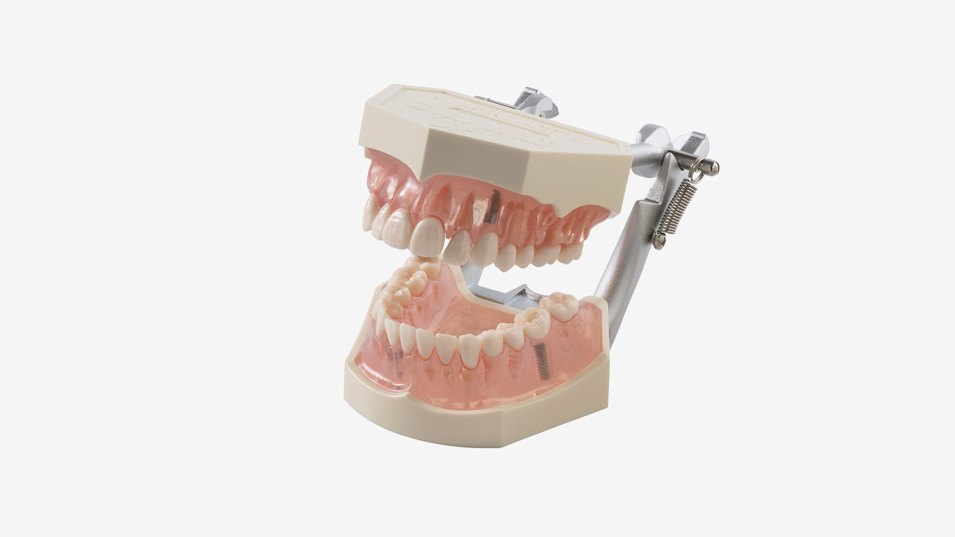 Implantologiemodell i21D-400ip, OK + UK mit herausnehmbarem Implantat, mit D-Artikulator